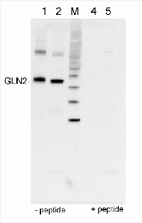GLN2 | GS2, chloroplastic form of glutamine synthetase in the group Antibodies Plant/Algal  / Nitrogen Metabolism at Agrisera AB (Antibodies for research) (AS08 296)
